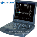 Medical Equipment 3D Laptop Ultrasound & color doppler